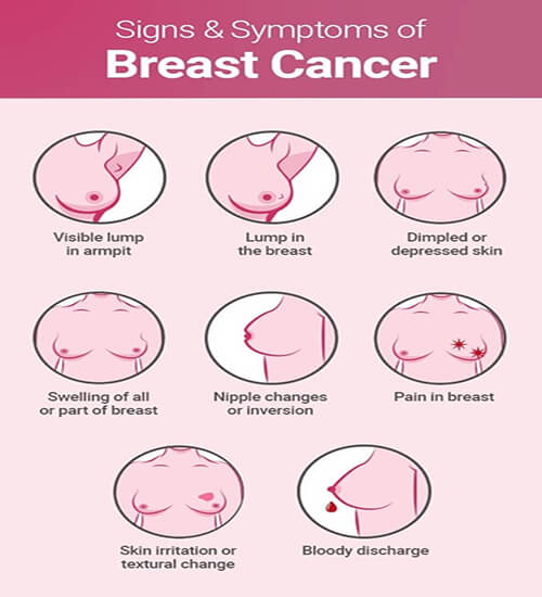 best breast oncologist saket