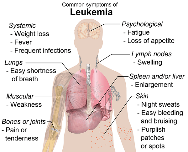 best leukemia specialist saket