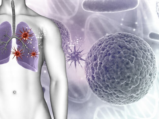 best lung cancer specialist delhi