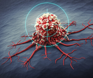 Best Targeted Therapy Doctor South Delhi