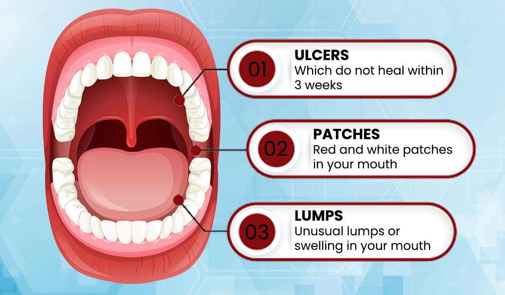 symptoms of oral cancer
