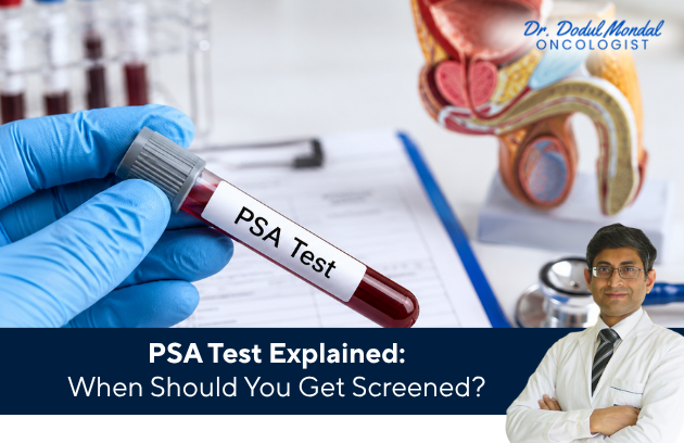 PSA blood test for prostate cancer screening